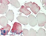 SCN8A / Nav1.6 Antibody - Human Skeletal Muscle: Formalin-Fixed, Paraffin-Embedded (FFPE)