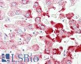 SCP2 / SCPX Antibody - Anti-SCP2 antibody IHC of human liver. Immunohistochemistry of formalin-fixed, paraffin-embedded tissue after heat-induced antigen retrieval. Antibody concentration 3.75 ug/ml.