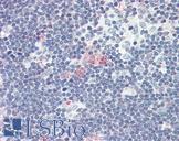 SDF1 / CXCL12 Antibody - Anti-CXCL12 antibody IHC of human thymus. Immunohistochemistry of formalin-fixed, paraffin-embedded tissue after heat-induced antigen retrieval. Antibody concentration 5 ug/ml.