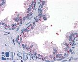 SDR9C1 / BDH1 Antibody - Anti-BDH1 antibody IHC of human prostate. Immunohistochemistry of formalin-fixed, paraffin-embedded tissue after heat-induced antigen retrieval. Antibody dilution 1:200.