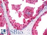 SEC14L2 Antibody - Human Prostate: Formalin-Fixed, Paraffin-Embedded (FFPE)