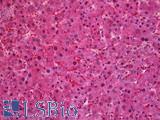 SEC61A1 / SEC61 Antibody - Anti-SEC61A1 / SEC61 antibody IHC of human liver. Immunohistochemistry of formalin-fixed, paraffin-embedded tissue after heat-induced antigen retrieval. Antibody concentration 3.75 ug/ml.