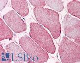 SEMA4B / Semaphorin 4B Antibody - Anti-SEMA4B antibody IHC of human skeletal muscle. Immunohistochemistry of formalin-fixed, paraffin-embedded tissue after heat-induced antigen retrieval.