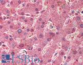 SERPINA1 / Alpha 1 Antitrypsin Antibody - Anti-Alpha-1-Antitrypsin antibody IHC of human liver. Immunohistochemistry of formalin-fixed, paraffin-embedded tissue after heat-induced antigen retrieval. Antibody concentration 5 ug/ml.