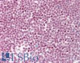 SF3B4 Antibody - Anti-SF3B4 antibody IHC staining of human tonsil. Immunohistochemistry of formalin-fixed, paraffin-embedded tissue after heat-induced antigen retrieval. Antibody concentration 10 ug/ml.