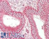 SFRP4 Antibody - Human Uterus: Formalin-Fixed, Paraffin-Embedded (FFPE)