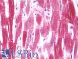 SHISA3 Antibody - Anti-SHISA3 antibody IHC staining of human heart. Immunohistochemistry of formalin-fixed, paraffin-embedded tissue after heat-induced antigen retrieval. Antibody concentration 10 ug/ml.