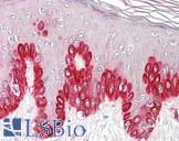 SIRT1 / Sirtuin 1 Antibody - Anti-SIRT1 antibody IHC of human skin. Immunohistochemistry of formalin-fixed, paraffin-embedded tissue after heat-induced antigen retrieval. Antibody dilution 3.75 ug/ml.
