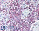 SLAMF6 / NTBA Antibody - Human Spleen: Formalin-Fixed, Paraffin-Embedded (FFPE)