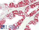 SLC16A1 / MCT1 Antibody - Human Prostate: Formalin-Fixed, Paraffin-Embedded (FFPE)