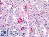 SLC18A3 / VACHT Antibody - Human Pituitary: Formalin-Fixed, Paraffin-Embedded (FFPE)