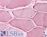 SLC1A5 / ASCT2 Antibody - Anti-SLC1A5 antibody IHC of human skeletal muscle. Immunohistochemistry of formalin-fixed, paraffin-embedded tissue after heat-induced antigen retrieval.