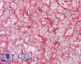 SLC22A1 Antibody - Anti-SLC22A1 / OCT1 antibody IHC staining of human liver. Immunohistochemistry of formalin-fixed, paraffin-embedded tissue after heat-induced antigen retrieval.