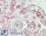 SLC28A2 Antibody - Human Placenta: Formalin-Fixed, Paraffin-Embedded (FFPE)