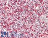 SLC2A6 / GLUT6 Antibody - Human Spleen: Formalin-Fixed, Paraffin-Embedded (FFPE)