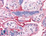 SLC31A1 / CTR1 Antibody - Anti-CTR1 antibody IHC of human placenta. Immunohistochemistry of formalin-fixed, paraffin-embedded tissue after heat-induced antigen retrieval.