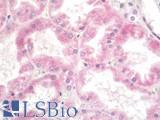 SLC38A3 / SNAT3 Antibody - Human Kidney: Formalin-Fixed, Paraffin-Embedded (FFPE)