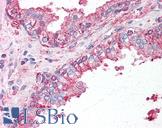 SLC39A6 / LIV-1 Antibody - Anti-SLC39A6 antibody IHC of human prostate. Immunohistochemistry of formalin-fixed, paraffin-embedded tissue after heat-induced antigen retrieval.