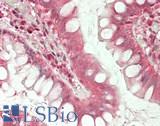 SLC3A1 / ATR1 Antibody - Human Small Intestine: Formalin-Fixed, Paraffin-Embedded (FFPE)