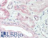 SLC4A11 / NABC1 Antibody - Anti-SLC4A11 / NABC1 antibody IHC staining of human kidney. Immunohistochemistry of formalin-fixed, paraffin-embedded tissue after heat-induced antigen retrieval.
