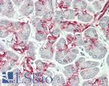 SLC4A7 Antibody - Human Pancreas: Formalin-Fixed, Paraffin-Embedded (FFPE)