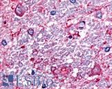 SLC5A3  Antibody - Anti-SLC5A3 antibody IHC of human spinal cord. Immunohistochemistry of formalin-fixed, paraffin-embedded tissue after heat-induced antigen retrieval.