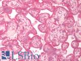 SLC5A6 / SMVT Antibody - Human Placenta: Formalin-Fixed, Paraffin-Embedded (FFPE)