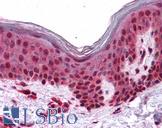 SLC5A6 / SMVT Antibody - Anti-SLC5A6 antibody IHC of human skin. Immunohistochemistry of formalin-fixed, paraffin-embedded tissue after heat-induced antigen retrieval.