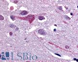 SLC5A9 / SGLT4 Antibody - Anti-SLC5A9 antibody IHC of human brain, cortex. Immunohistochemistry of formalin-fixed, paraffin-embedded tissue after heat-induced antigen retrieval.