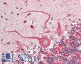 SLC6A1 / GAT-1 Antibody - Human Brain, Cerebellum: Formalin-Fixed, Paraffin-Embedded (FFPE)