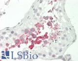 SLC6A1 / GAT-1 Antibody - Human Testis: Formalin-Fixed, Paraffin-Embedded (FFPE)
