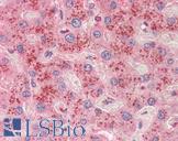 SLC6A12 / BGT-1 Antibody - Anti-SLC6A12 / BGT-1 antibody IHC staining of human liver. Immunohistochemistry of formalin-fixed, paraffin-embedded tissue after heat-induced antigen retrieval. Antibody concentration 10 ug/ml.