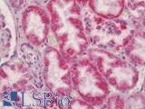 SLC7A8 / LAT2 Antibody - Human Kidney: Formalin-Fixed, Paraffin-Embedded (FFPE)