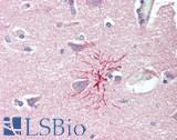 SLC8A3 / NCX3 Antibody - Human Brain, Cortex: Formalin-Fixed, Paraffin-Embedded (FFPE), at a concentration of 10 ug/ml. 