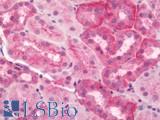 SLC9A1 / NHE1 Antibody - Human Kidney: Formalin-Fixed, Paraffin-Embedded (FFPE)