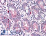 SLC9A1 / NHE1 Antibody - Anti-SLC9A1 antibody IHC of human small intestine. Immunohistochemistry of formalin-fixed, paraffin-embedded tissue after heat-induced antigen retrieval. Antibody concentration 5 ug/ml.