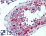 SLCO1A2 / OATP Antibody - Human Testis: Formalin-Fixed, Paraffin-Embedded (FFPE)