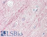 SLIT1 Antibody - Anti-SLIT1 / SLIT-1 antibody IHC staining of human brain, cortex. Immunohistochemistry of formalin-fixed, paraffin-embedded tissue after heat-induced antigen retrieval.