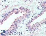 SLITRK6 Antibody - Anti-SLITRK6 antibody IHC of human prostate. Immunohistochemistry of formalin-fixed, paraffin-embedded tissue after heat-induced antigen retrieval.
