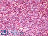 SLX4 Antibody - Human Tonsil: Formalin-Fixed, Paraffin-Embedded (FFPE)