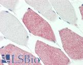 SMAD2 Antibody - Anti-SMAD2 antibody IHC staining of human skeletal muscle. Immunohistochemistry of formalin-fixed, paraffin-embedded tissue after heat-induced antigen retrieval. Antibody dilution 1:200.