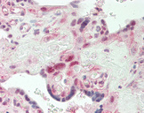 SMARCA4 / BRG1 Antibody - Human Placenta: Formalin-Fixed, Paraffin-Embedded (FFPE)