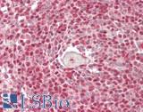 SNRPA1 Antibody - Human Spleen: Formalin-Fixed, Paraffin-Embedded (FFPE)