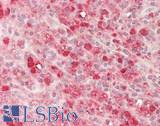 SNX20 Antibody - Human Spleen: Formalin-Fixed, Paraffin-Embedded (FFPE)