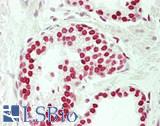 SOX5 Antibody - Human Prostate: Formalin-Fixed, Paraffin-Embedded (FFPE)