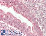 SPTLC1 / HSN1 Antibody - Human Uterus: Formalin-Fixed, Paraffin-Embedded (FFPE)