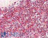 SSH3 Antibody - Human Spleen: Formalin-Fixed, Paraffin-Embedded (FFPE)