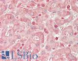 STK25 Antibody - Human Liver: Formalin-Fixed, Paraffin-Embedded (FFPE).  This image was taken for the unconjugated form of this product. Other forms have not been tested.
