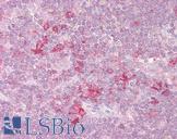 STK26 / MST4 Antibody - Anti-MST4 antibody IHC of human thymus. Immunohistochemistry of formalin-fixed, paraffin-embedded tissue after heat-induced antigen retrieval. Antibody concentration 2.5 ug/ml.