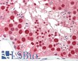 STK36 Antibody - Human Testis: Formalin-Fixed, Paraffin-Embedded (FFPE)